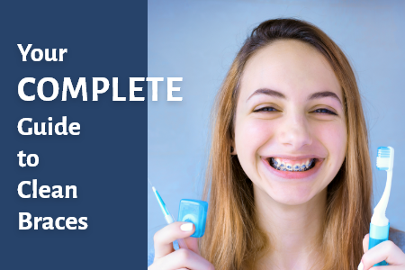 A Complete Guide for Keeping Braces Clean (featured image)