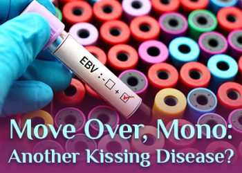 Dansville dentist, Dr. Vogler at A Smile by Design talks about a kissing disease you might be less familiar with than mononucleosis.