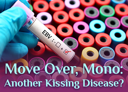 Move Over, Mono: Another Kissing Disease? (featured image)