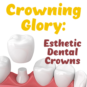 Crowning Glory: esthetic dental crowns
