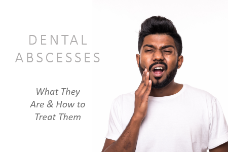 Dental Abscesses: What They Are and How to Treat Them (featured image)