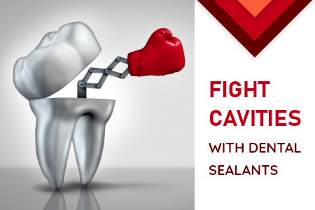 How to use Dental Sealants to Fight Cavities (featured image)