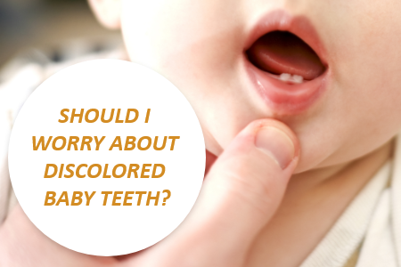 Should You Worry about Discolored Baby Teeth? (featured image)