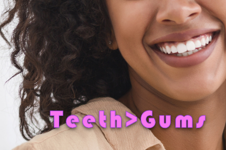 Gum Lifts: Less Gum, More Teeth Equals A Beautiful Smile (featured image)