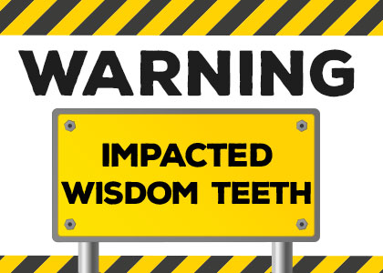 Warning Signs of Impacted Wisdom Teeth (featured image)