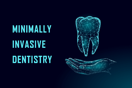 Why You Should Care About Minimally Invasive Dentistry (featured image)