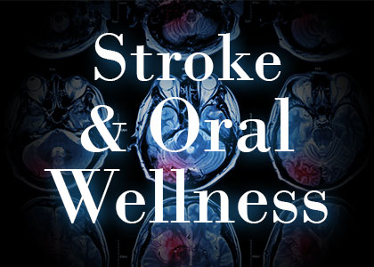 Dansville dentist Dr. James Vogler of A Smile by Design explains the connection between oral wellness and stroke, and how you can increase your protection.