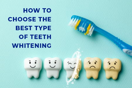 How To Choose The Best Type Of Teeth Whitening (featured image)