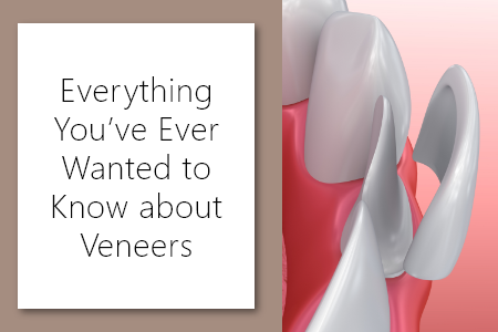 Dansville dentist, Dr. Vogler at A Smile by Design fills you in on everything you want to know about veneers.