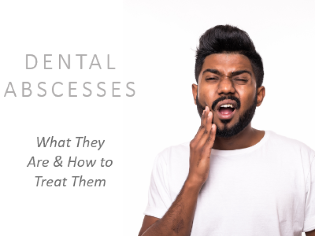 Dental Abscesses: What They Are and How to Treat Them (featured image)
