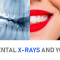 Dental X-rays and You; Everything You Need to Know (featured image)