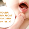 Should You Worry about Discolored Baby Teeth? (featured image)