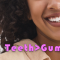 Gum Lifts: Less Gum, More Teeth Equals A Beautiful Smile (featured image)