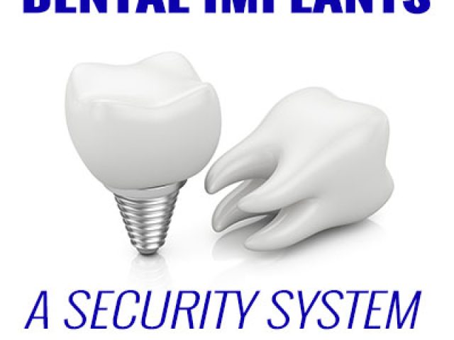 Dental Implants – A Security System for Your Smile (featured image)