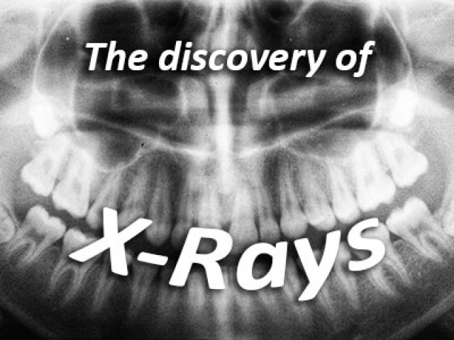 The Discovery of X-Rays (featured image)